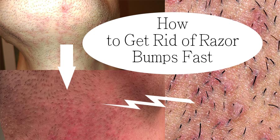 Bump deep in vagina Bump deep in vagina