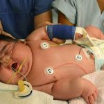 Top 10 Biggest Babies Ever Born biggest baby ever born