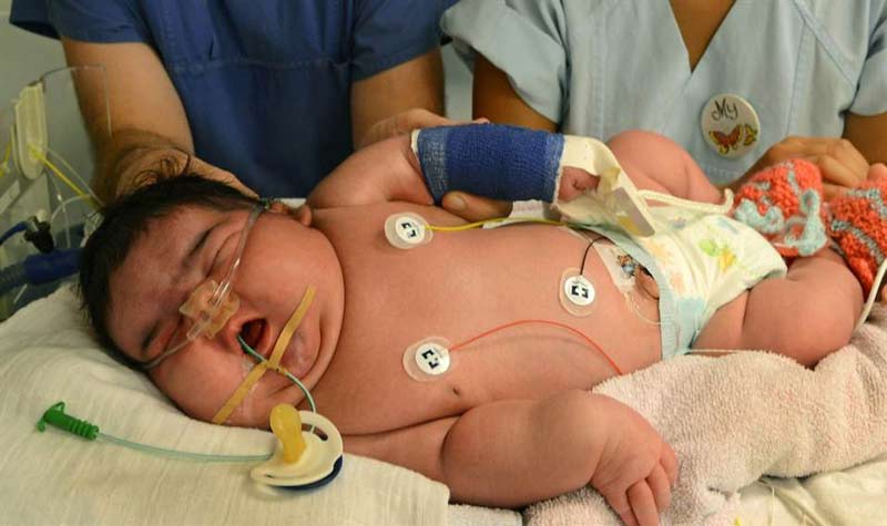 Biggest Baby Ever Born & Top 10 Heaviest Babies [2022]