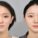 How to Lose Face Fat how to lose face fat