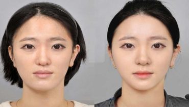how to lose face fat